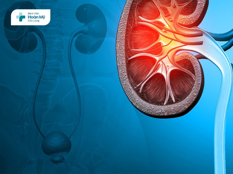 Things You Need to Know About Tumors of the Urinary System