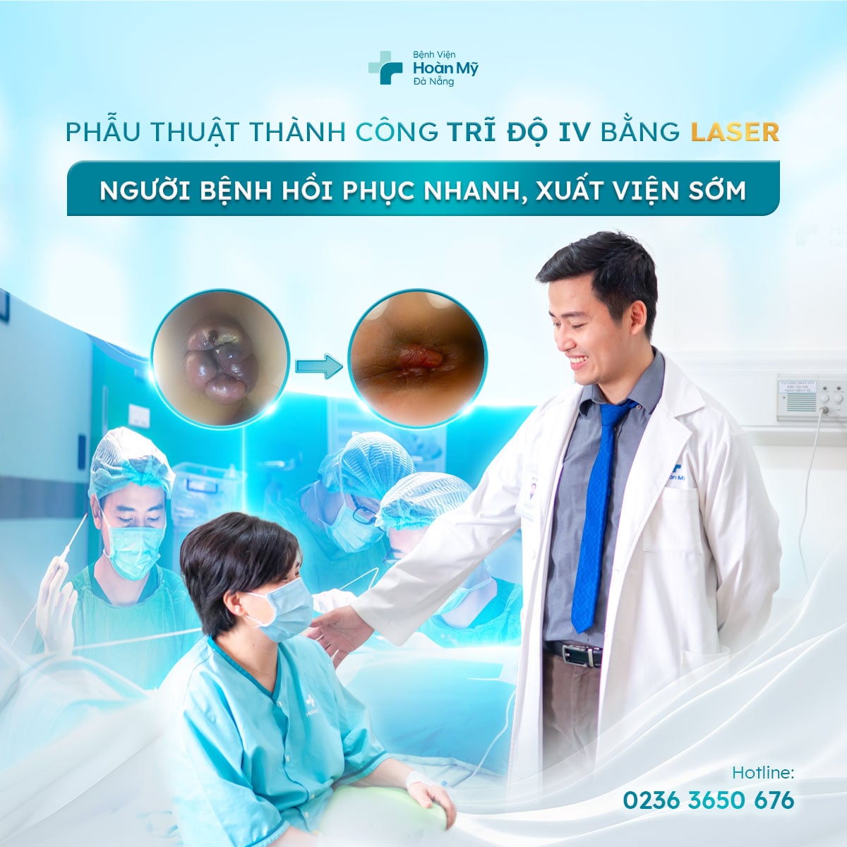 Phẫu thuật thành công ca trĩ độ IV bằng công nghệ Laser – Bước tiến trong điều trị ít xâm lấn