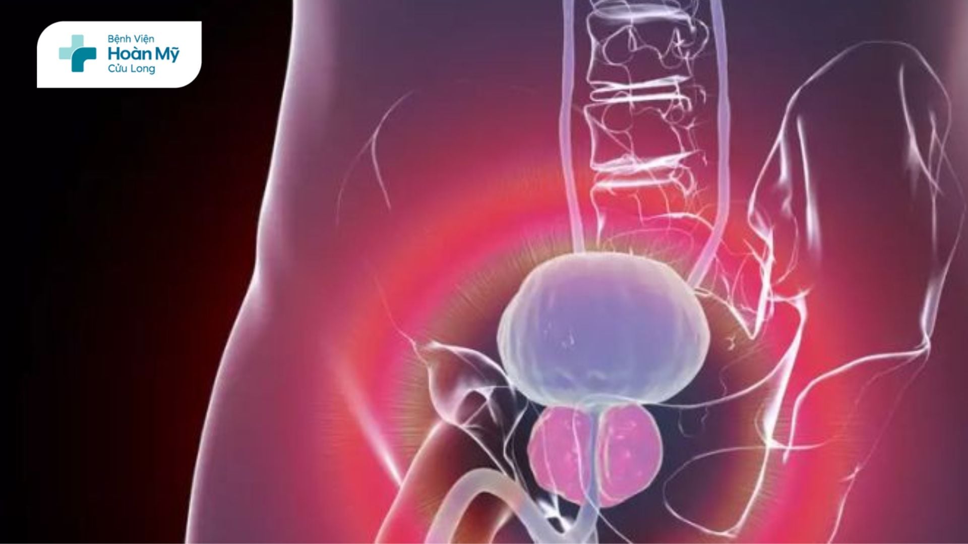 Tăng sinh lành tính tuyến tiền liệt: Dấu hiệu nhận biết và cách chăm sóc hiệu quả